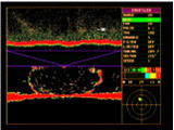 WESMAR TCS 335 Trawl Sonar
